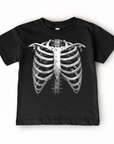 X-Ray